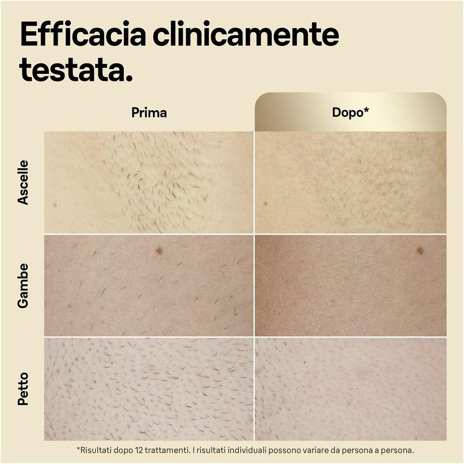 Braun Silk-expert Pro 5 PL5356 epilatore IPL con 10 livelli di intensità